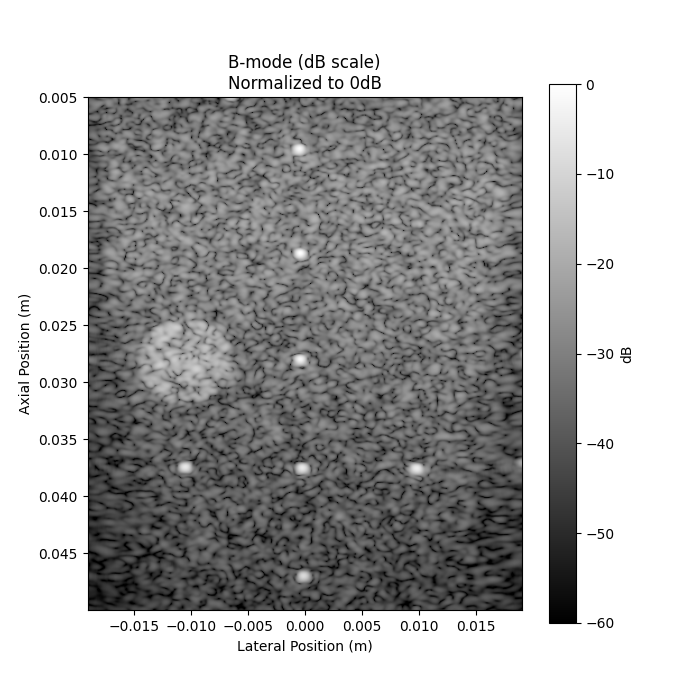 B-mode (dB scale) Normalized to 0dB