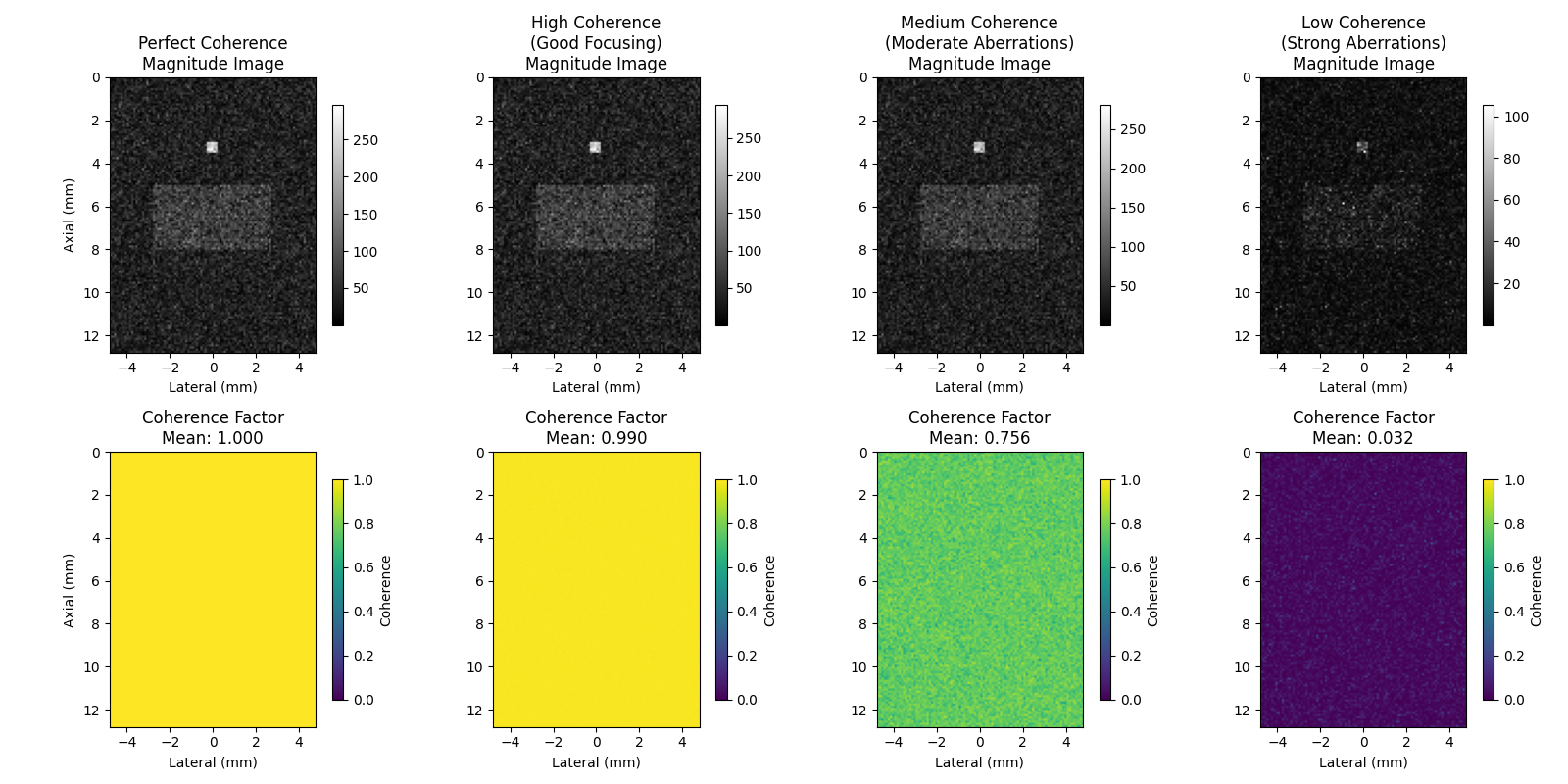 Perfect Coherence Magnitude Image, High Coherence (Good Focusing) Magnitude Image, Medium Coherence (Moderate Aberrations) Magnitude Image, Low Coherence (Strong Aberrations) Magnitude Image, Coherence Factor Mean: 1.000, Coherence Factor Mean: 0.990, Coherence Factor Mean: 0.756, Coherence Factor Mean: 0.032