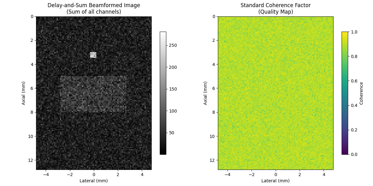 Delay-and-Sum Beamformed Image (Sum of all channels), Standard Coherence Factor (Quality Map)