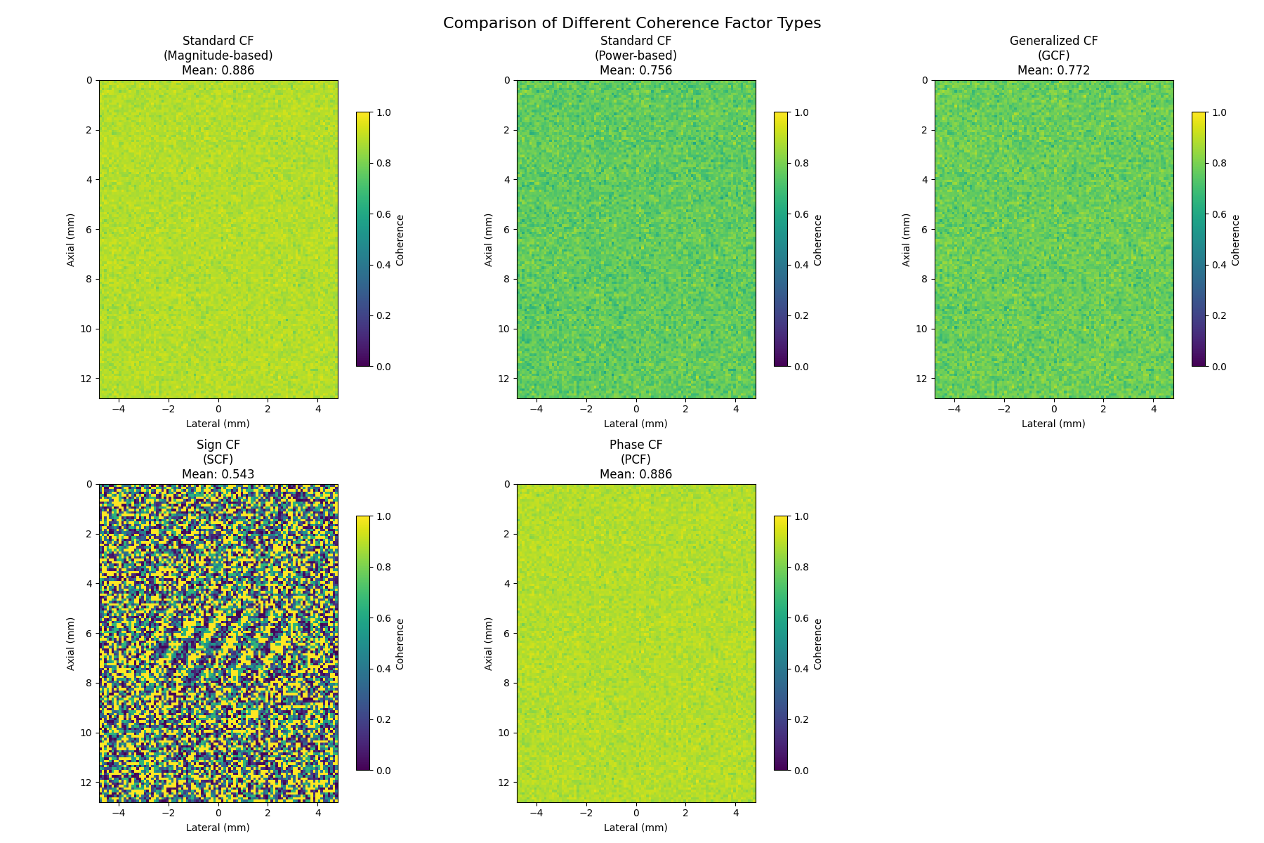 Comparison of Different Coherence Factor Types, Standard CF (Magnitude-based) Mean: 0.886, Standard CF (Power-based) Mean: 0.756, Generalized CF (GCF) Mean: 0.772, Sign CF (SCF) Mean: 0.543, Phase CF (PCF) Mean: 0.886
