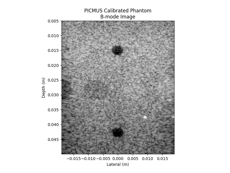 PICMUS Calibrated Phantom B-mode Image