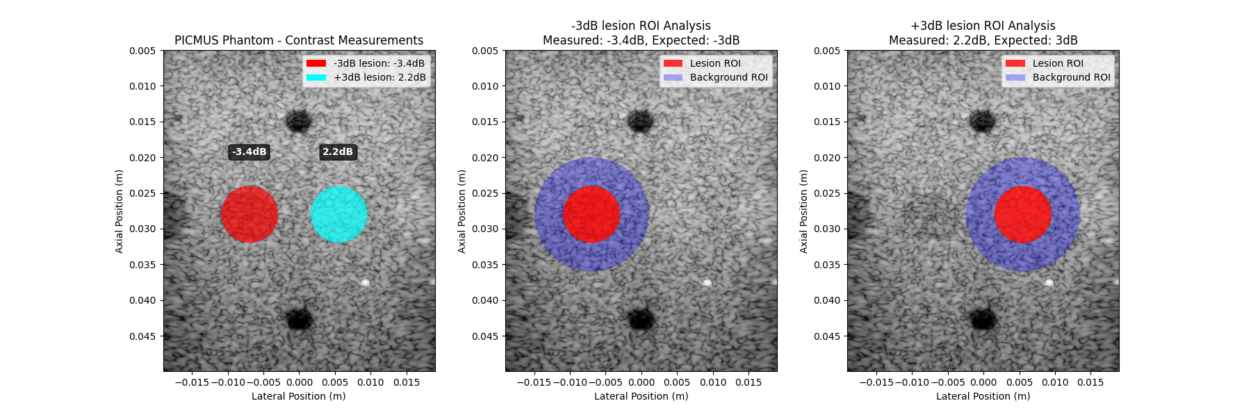 PICMUS Phantom - Contrast Measurements, -3dB lesion ROI Analysis Measured: -3.4dB, Expected: -3dB, +3dB lesion ROI Analysis Measured: 2.2dB, Expected: 3dB