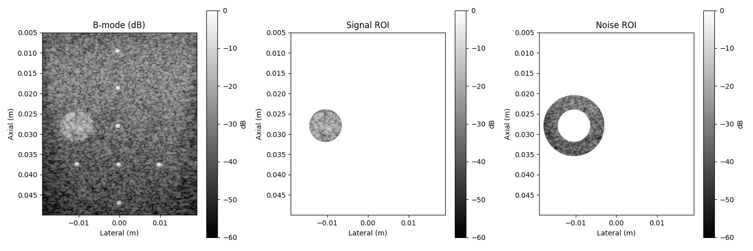 B-mode (dB), Signal ROI, Noise ROI