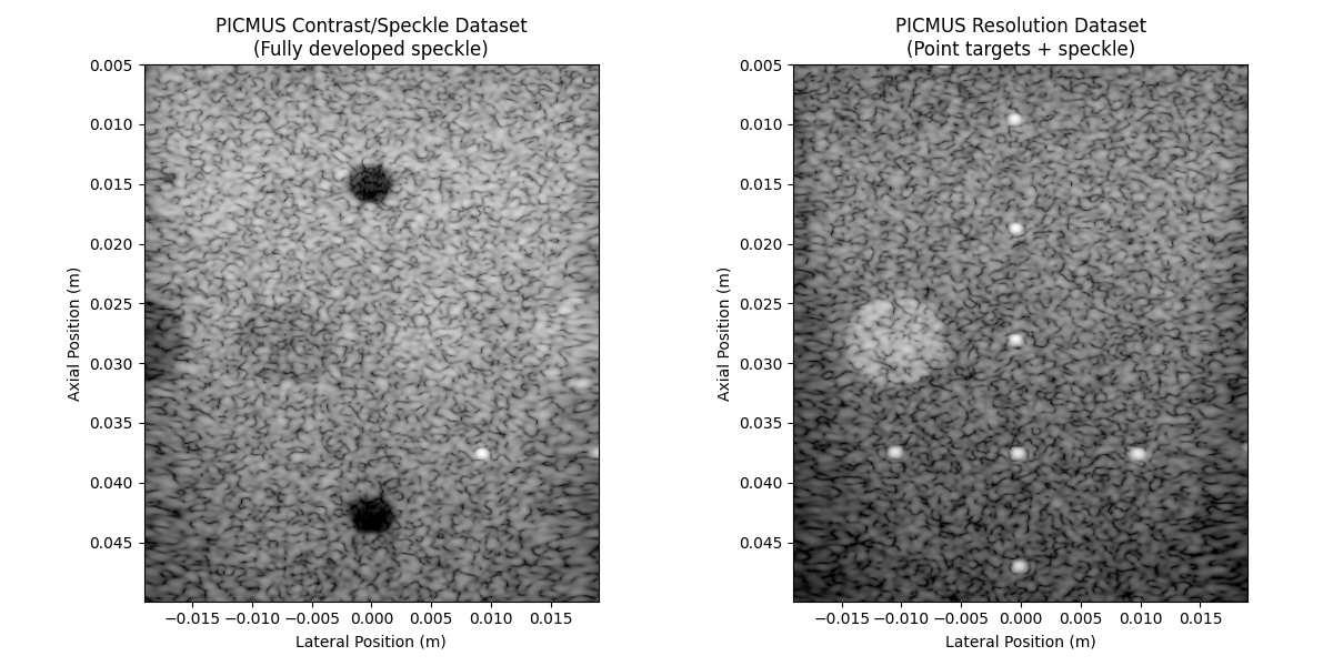 PICMUS Contrast/Speckle Dataset (Fully developed speckle), PICMUS Resolution Dataset (Point targets + speckle)