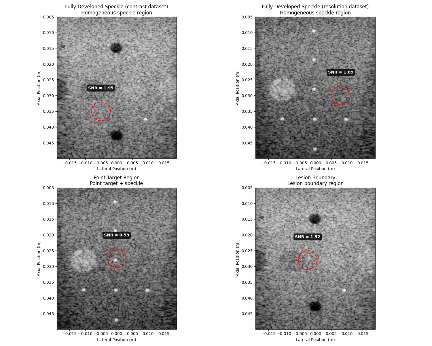 Fully Developed Speckle (contrast dataset) Homogeneous speckle region, Fully Developed Speckle (resolution dataset) Homogeneous speckle region, Point Target Region Point target + speckle, Lesion Boundary Lesion boundary region