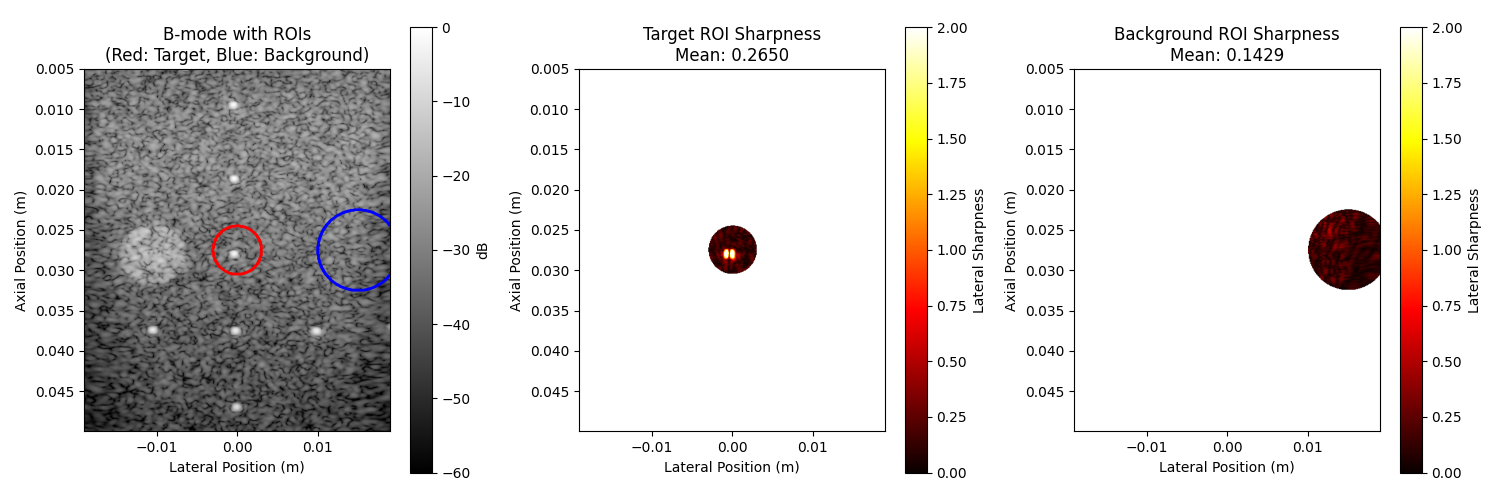 B-mode with ROIs (Red: Target, Blue: Background), Target ROI Sharpness Mean: 0.2650, Background ROI Sharpness Mean: 0.1429