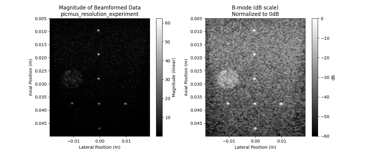 Magnitude of Beamformed Data picmus_resolution_experiment, B-mode (dB scale) Normalized to 0dB